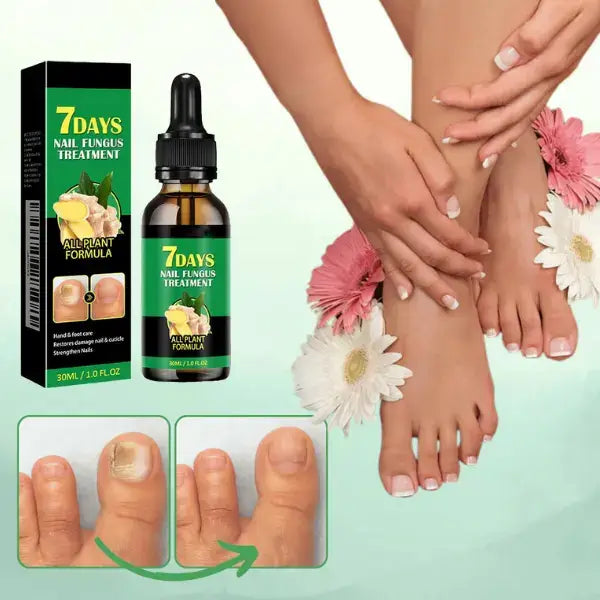 Aceite Milagroso para Uñas