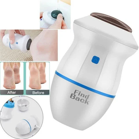 Pulidor Eléctrico SmoothFeet PLUS