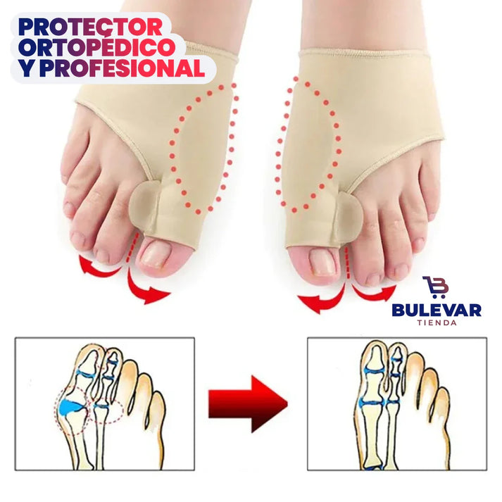 🦶 Corrector de Juanetes – Alivia el Dolor sin Cirugía